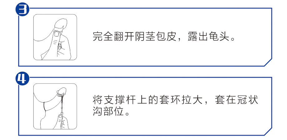 勃乐阴茎支架使用方法1