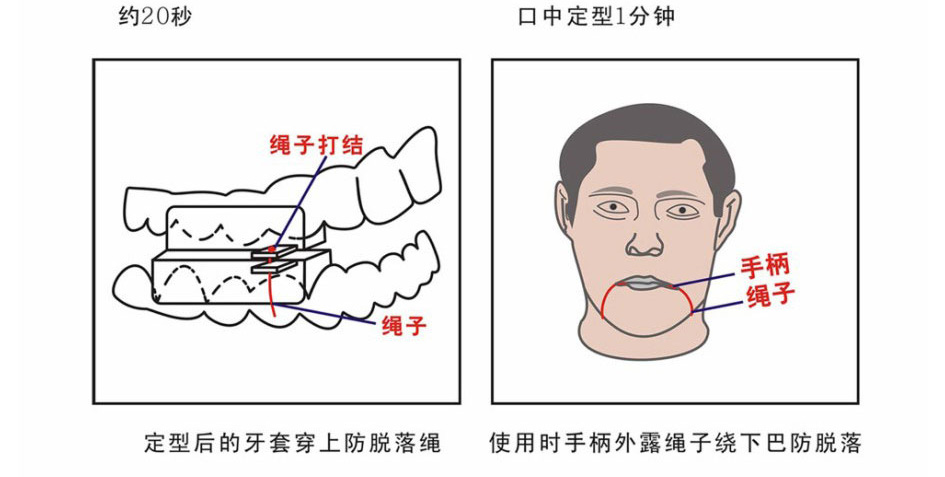 ���ͣ����ʹ��ͼ��3