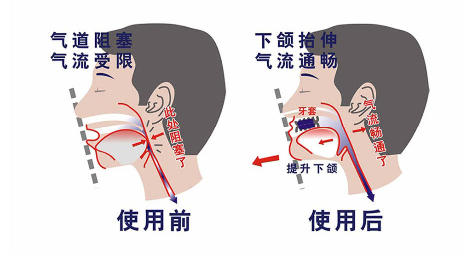 ���ͣ����ʹ��ͼ��4