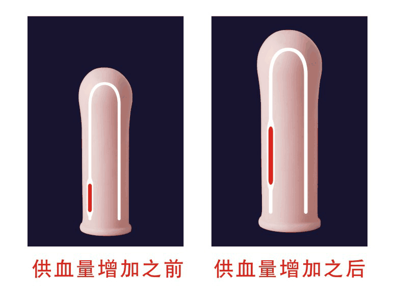 电动勃乐起勃器供血量增加前后对比图